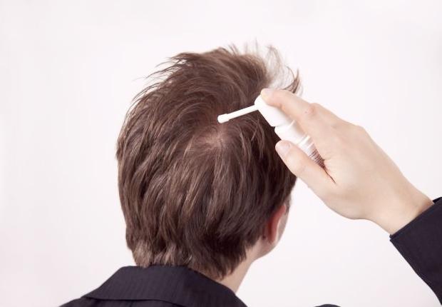 Что такое миноксидил - интернет-магазин средств для роста волос: лечение  облысения и кожи головы – triholog.ru